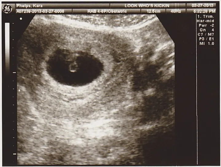 We're Having A Baby...!