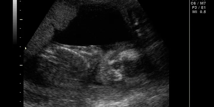 It's a....
