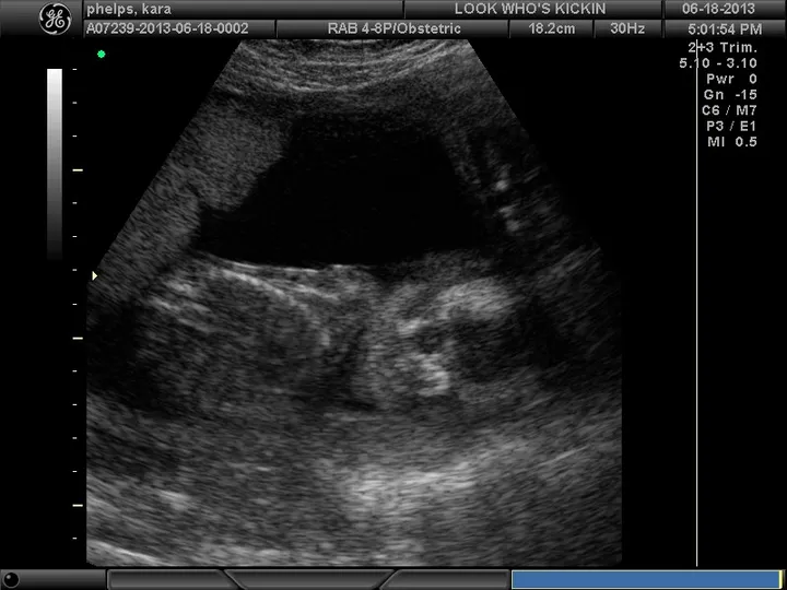 It's a....